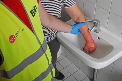 Brandwonden Koelen Kraan Bhv